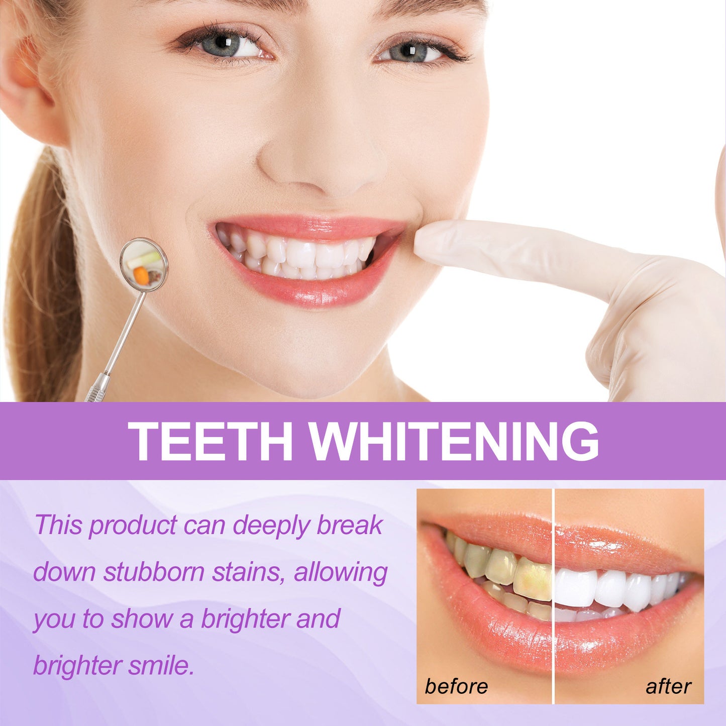 PurpleT™ – Smile Care Purple Whitening Strips