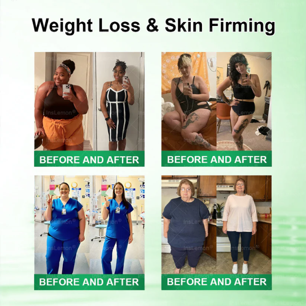 InsLemon® 10-in-1 Metabolic Support Patch - Moringa, Berberine & AMPK Visible Results in 7 Days | Advanced Nano-Microneedle Technology for Weight Management & Skin Firming.