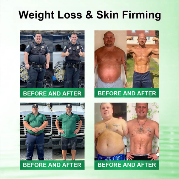 InsLemon® 10-in-1 Metabolic Support Patch - Moringa, Berberine & AMPK Visible Results in 7 Days | Advanced Nano-Microneedle Technology for Weight Management & Skin Firming.