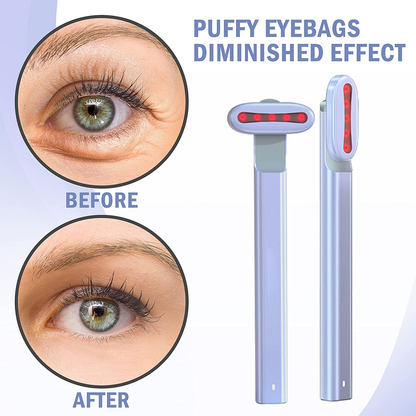 Derm™- 4-in-1 LED Red Light Therapy Facial Wand