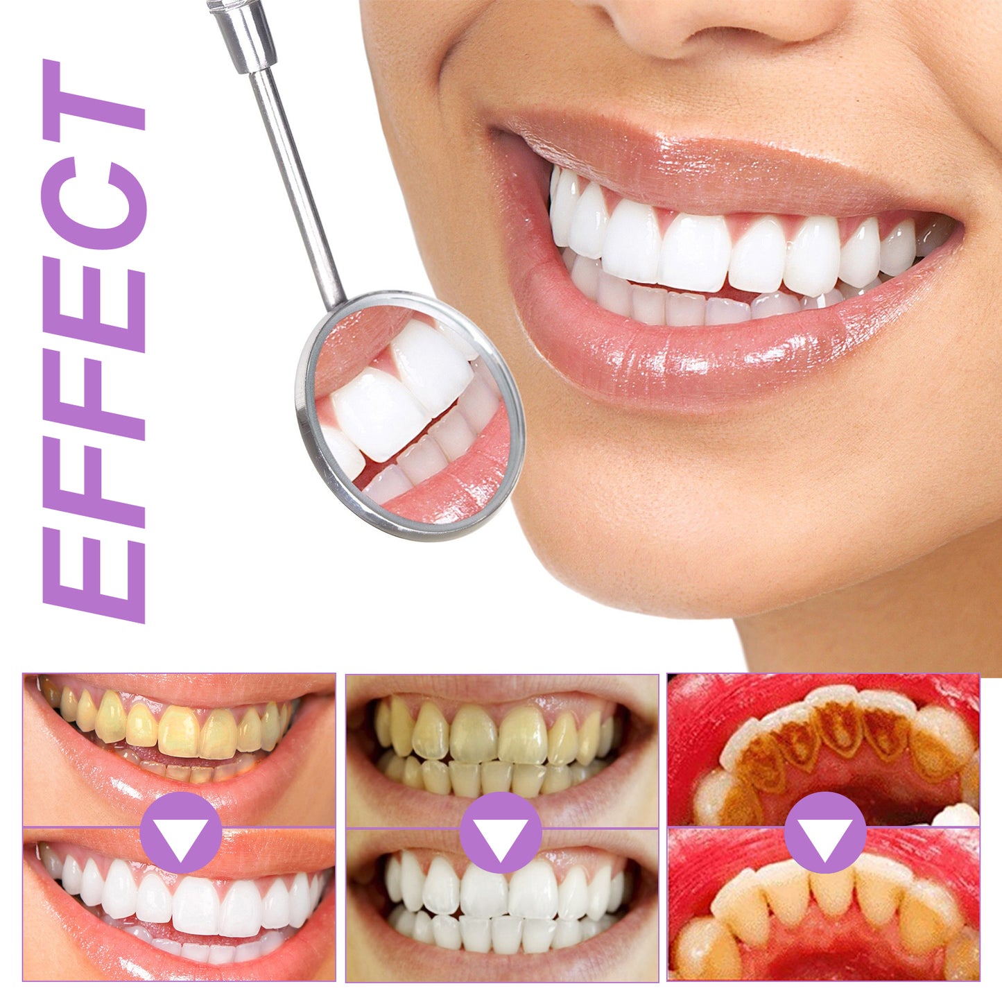 PurpleT™ – Smile Care Purple Whitening Strips