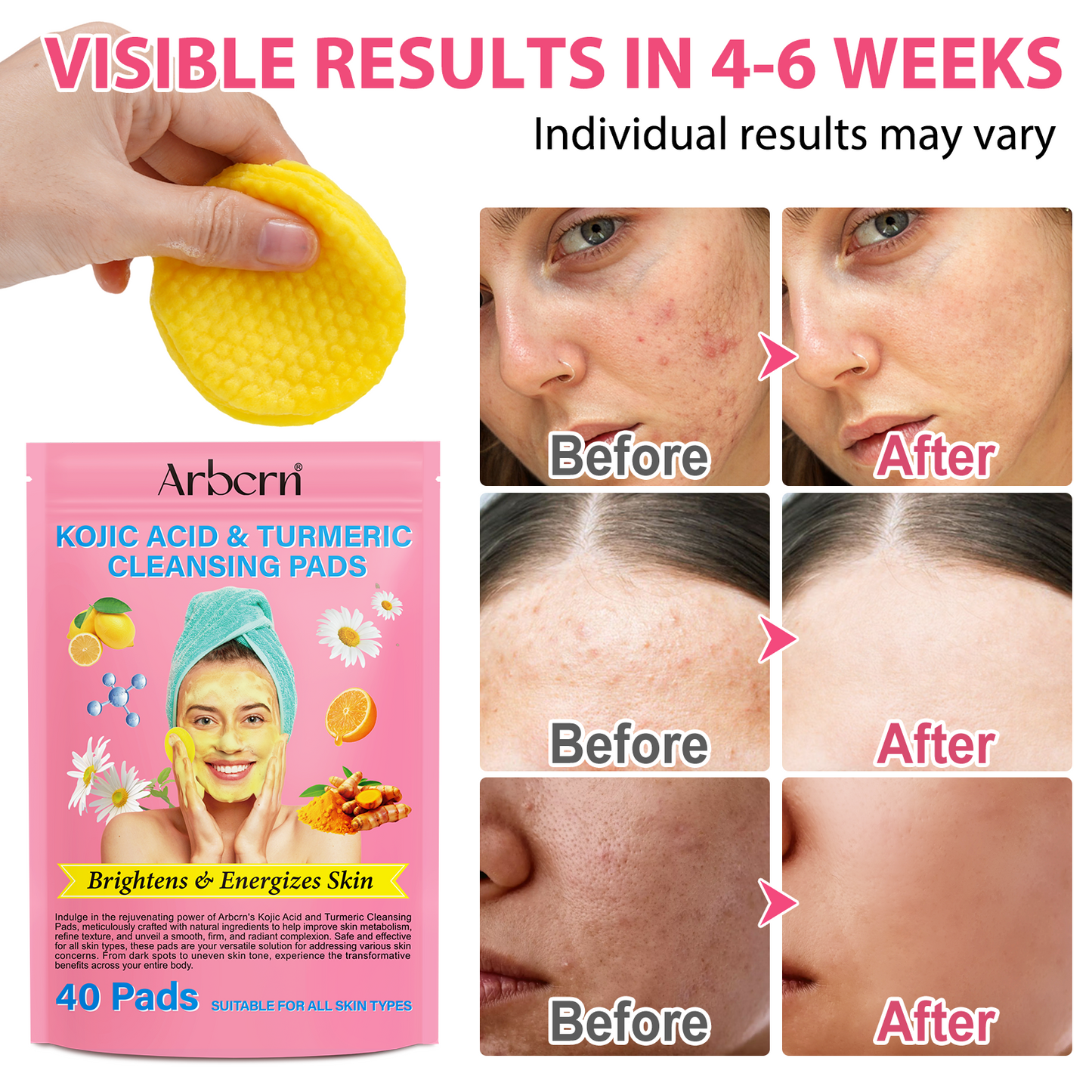 Gloxy™- Cleansing glow pads (Kojic + Turmeric)