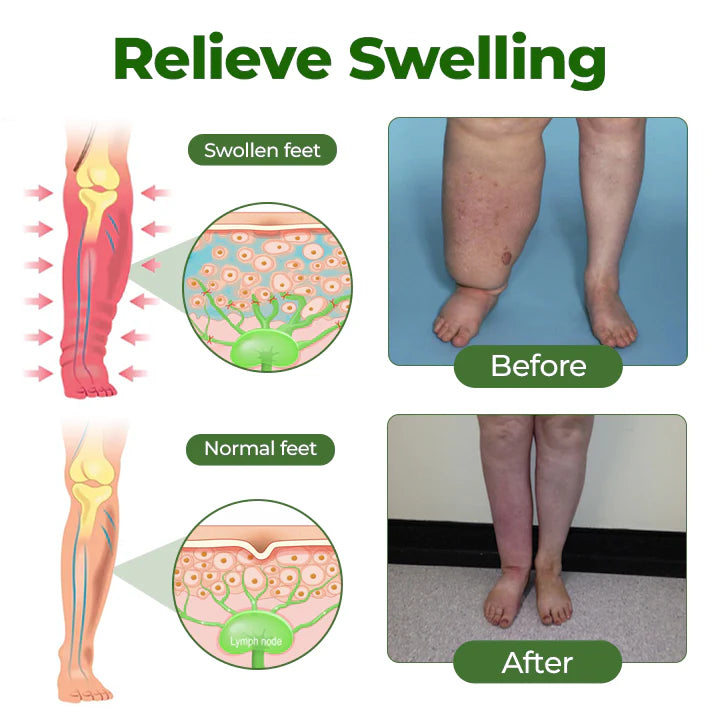 Venox® Professional Leg Circulation Cream