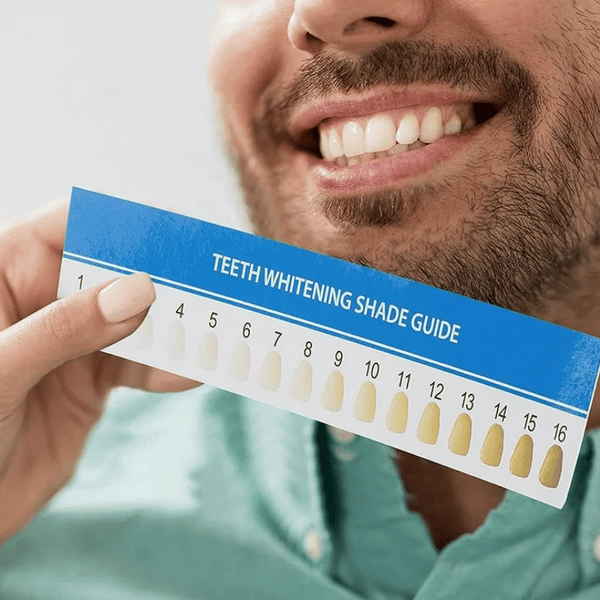 Before & After shade guide